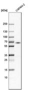 Long-chain-fatty-acid--CoA ligase 5 antibody, HPA007162, Atlas Antibodies, Western Blot image 