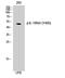 Interleukin 13 Receptor Subunit Alpha 1 antibody, STJ90718, St John