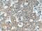 ER Degradation Enhancing Alpha-Mannosidase Like Protein 3 antibody, 27310-1-AP, Proteintech Group, Immunohistochemistry paraffin image 