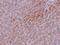 TBK1 Binding Protein 1 antibody, PA5-20814, Invitrogen Antibodies, Immunohistochemistry paraffin image 