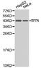 Tissue Factor Pathway Inhibitor antibody, LS-C192914, Lifespan Biosciences, Western Blot image 
