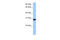 Tryptophanyl TRNA Synthetase 2, Mitochondrial antibody, 30-809, ProSci, Enzyme Linked Immunosorbent Assay image 