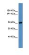 HPS3 Biogenesis Of Lysosomal Organelles Complex 2 Subunit 1 antibody, orb329564, Biorbyt, Western Blot image 