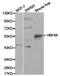 Hepatocyte Nuclear Factor 4 Alpha antibody, TA327262, Origene, Western Blot image 