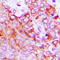 Erb-B2 Receptor Tyrosine Kinase 4 antibody, LS-C356027, Lifespan Biosciences, Immunohistochemistry paraffin image 