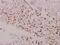 BCL2 antibody, PA5-36742, Invitrogen Antibodies, Immunohistochemistry frozen image 