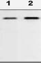 Histone Deacetylase 5 antibody, ab1439, Abcam, Western Blot image 