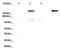 Dipeptidyl Peptidase Like 6 antibody, NBP1-59925, Novus Biologicals, Western Blot image 