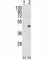 CCAAT Enhancer Binding Protein Beta antibody, F49889-0.4ML, NSJ Bioreagents, Western Blot image 