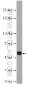 Receptor Interacting Serine/Threonine Kinase 3 antibody, 17563-1-AP, Proteintech Group, Western Blot image 