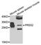 Trypsin-2 antibody, MBS9128655, MyBioSource, Western Blot image 