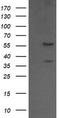 Chaperonin Containing TCP1 Subunit 8 Like 2 antibody, TA505335S, Origene, Western Blot image 