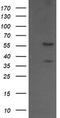 Chaperonin Containing TCP1 Subunit 8 Like 2 antibody, TA505335S, Origene, Western Blot image 