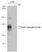 Fibroblast Growth Factor Receptor 1 antibody, GTX133459, GeneTex, Western Blot image 