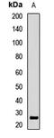 Ribonuclease A Family Member 11 (Inactive) antibody, orb411829, Biorbyt, Western Blot image 
