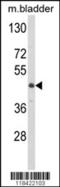 Lumican antibody, MBS9207393, MyBioSource, Western Blot image 