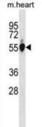 PGI antibody, abx031130, Abbexa, Western Blot image 