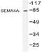 Semaphorin-4A antibody, AP20459PU-N, Origene, Western Blot image 