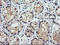Parvin Alpha antibody, LS-C797707, Lifespan Biosciences, Immunohistochemistry paraffin image 