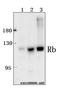 RB Transcriptional Corepressor 1 antibody, A00039, Boster Biological Technology, Western Blot image 