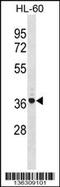 TNFAIP3 Interacting Protein 2 antibody, 58-630, ProSci, Western Blot image 