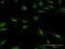 Protein Phosphatase 2 Catalytic Subunit Beta antibody, H00005516-B01P, Novus Biologicals, Immunofluorescence image 