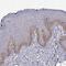 Tachykinin Receptor 1 antibody, NBP2-57675, Novus Biologicals, Immunohistochemistry paraffin image 