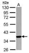 Major Histocompatibility Complex, Class I, A antibody, PA5-29911, Invitrogen Antibodies, Western Blot image 