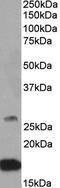 Ciliary Neurotrophic Factor antibody, EB10527, Everest Biotech, Western Blot image 