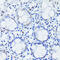 Aryl Hydrocarbon Receptor Nuclear Translocator antibody, GTX00799, GeneTex, Immunohistochemistry paraffin image 