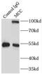 Colorectal mutant cancer protein antibody, FNab05046, FineTest, Immunoprecipitation image 