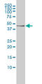 Testin LIM Domain Protein antibody, LS-B6222, Lifespan Biosciences, Western Blot image 