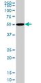 Bone Morphogenetic Protein 5 antibody, H00000653-M82, Novus Biologicals, Western Blot image 