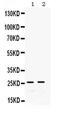 Glutathione S-Transferase Alpha 1 antibody, PA5-79336, Invitrogen Antibodies, Western Blot image 