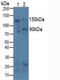 Integrin Subunit Alpha V antibody, MBS2027915, MyBioSource, Western Blot image 