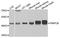 Peptidase, Mitochondrial Processing Beta Subunit antibody, A11793, Boster Biological Technology, Western Blot image 