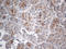 Interferon Lambda Receptor 1 antibody, LS-C799191, Lifespan Biosciences, Immunohistochemistry paraffin image 