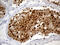 Rac GTPase Activating Protein 1 antibody, M03018, Boster Biological Technology, Immunohistochemistry paraffin image 