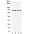 Dipeptidyl Peptidase 4 antibody, R32041, NSJ Bioreagents, Western Blot image 