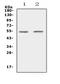 Vitamin K-dependent protein C antibody, A01742, Boster Biological Technology, Western Blot image 