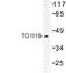 Oxoeicosanoid Receptor 1 antibody, LS-C177421, Lifespan Biosciences, Western Blot image 