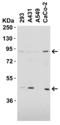 CD248 Molecule antibody, 4357, ProSci, Western Blot image 