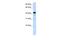 Surfactant Protein B antibody, PA5-42000, Invitrogen Antibodies, Western Blot image 