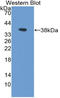 Lactate Dehydrogenase B antibody, LS-C314252, Lifespan Biosciences, Western Blot image 