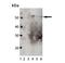 Inositol Hexakisphosphate Kinase 2 antibody, M08792, Boster Biological Technology, Western Blot image 