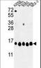 Histone Cluster 1 H2A Family Member H antibody, LS-C166889, Lifespan Biosciences, Western Blot image 