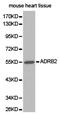 CD200 Molecule antibody, LS-C193040, Lifespan Biosciences, Western Blot image 