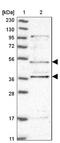 Amine Oxidase Copper Containing 1 antibody, NBP1-89068, Novus Biologicals, Western Blot image 