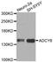 Adenylate Cyclase 8 antibody, MBS128808, MyBioSource, Western Blot image 