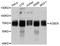 Acyl-CoA Binding Domain Containing 5 antibody, A10595, ABclonal Technology, Western Blot image 